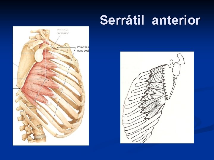 Serrátil anterior 