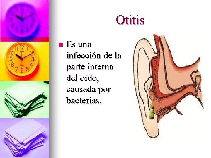 Otitis n Es una infección de la parte interna del oído, causada por bacterias.