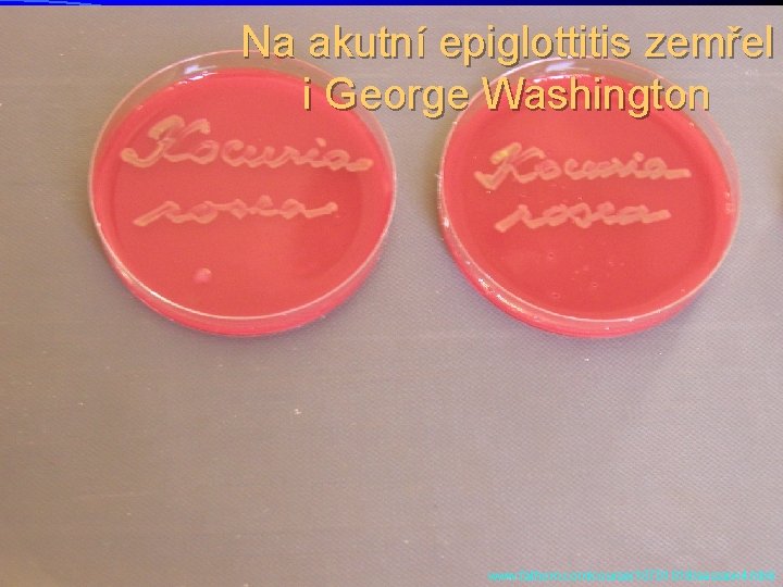 Na akutní epiglottitis zemřel i George Washington www. fathom. com/course/10701018/session 4. html 