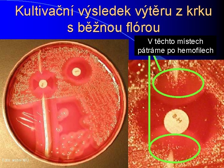 Kultivační výsledek výtěru z krku s běžnou flórou V těchto místech pátráme po hemofilech