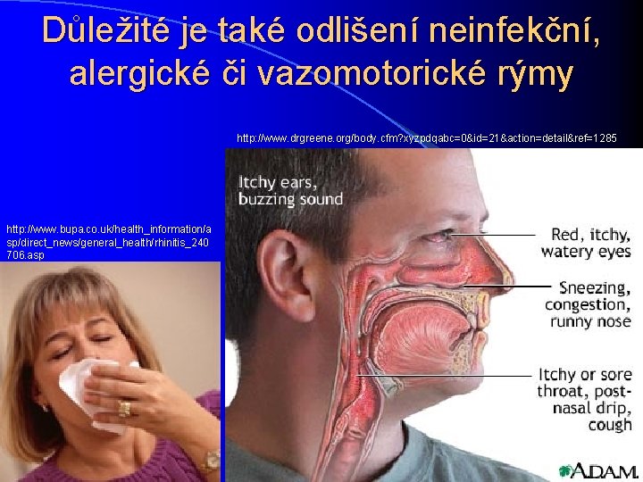 Důležité je také odlišení neinfekční, alergické či vazomotorické rýmy http: //www. drgreene. org/body. cfm?