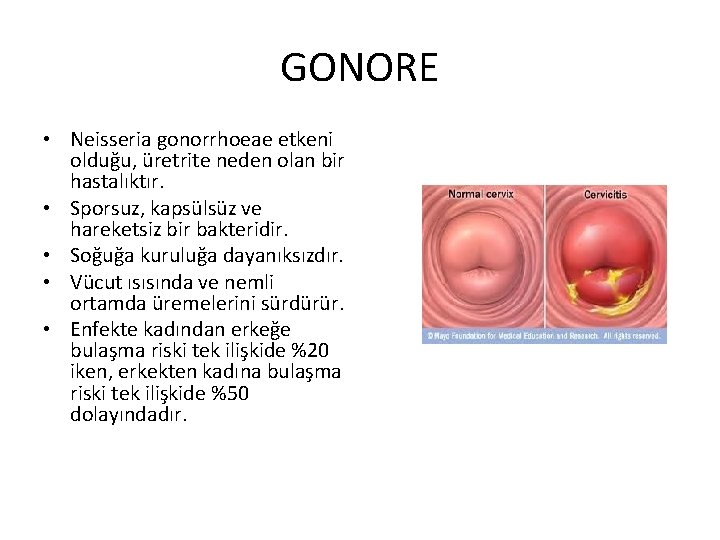 GONORE • Neisseria gonorrhoeae etkeni olduğu, üretrite neden olan bir hastalıktır. • Sporsuz, kapsülsüz