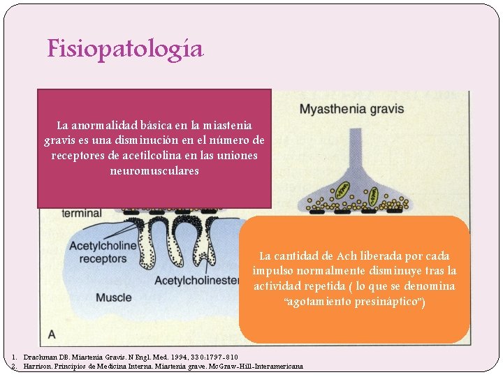 Fisiopatología La anormalidad básica en la miastenia gravis es una disminución en el número