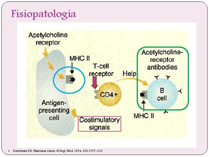 Fisiopatología 1. Drachman DB. Miastenia Gravis. N Engl. Med. 1994, 330: 1797 -810 