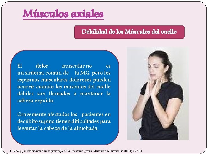 Músculos axiales Debilidad de los Músculos del cuello El dolor muscular no es un