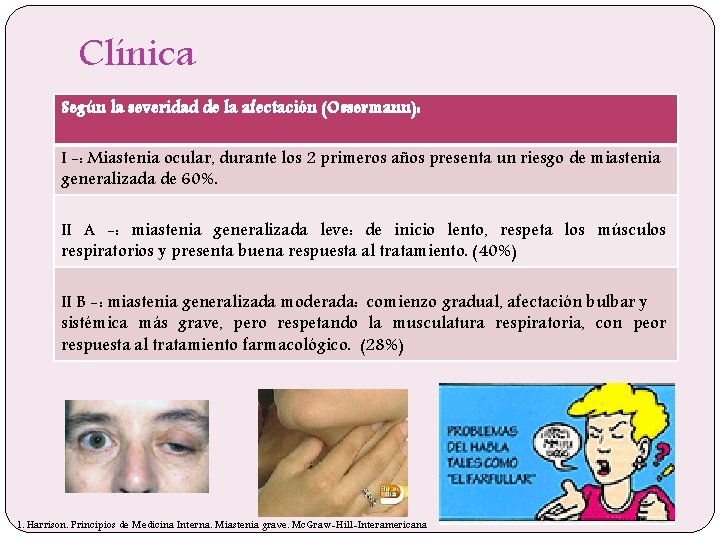 Clínica Según la severidad de la afectación (Ossermann): I -: Miastenia ocular, durante los