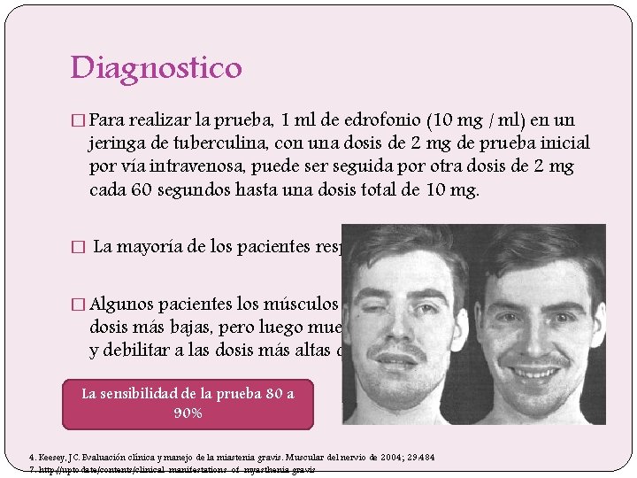 Diagnostico � Para realizar la prueba, 1 ml de edrofonio (10 mg / ml)