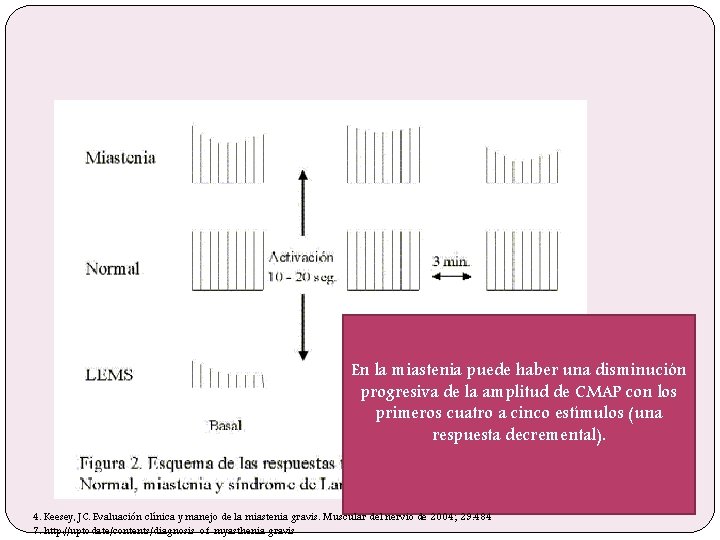 En la miastenia puede haber una disminución progresiva de la amplitud de CMAP con