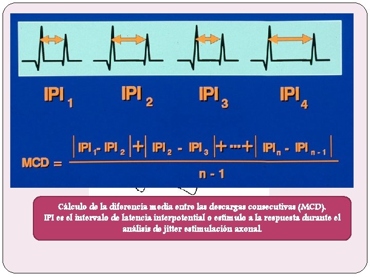 Cálculo de la diferencia media entre las descargas consecutivas (MCD). IPI es el intervalo