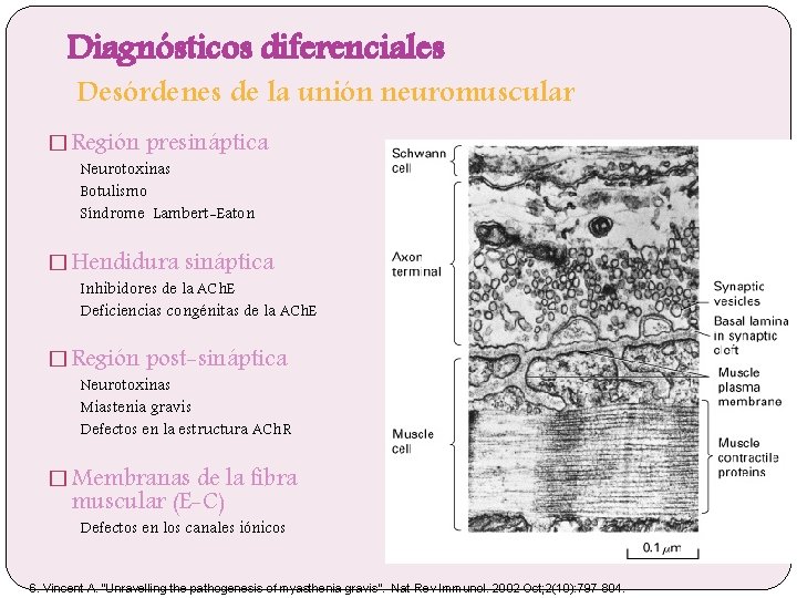 Diagnósticos diferenciales Desórdenes de la unión neuromuscular � Región presináptica Neurotoxinas Botulismo Síndrome Lambert-Eaton