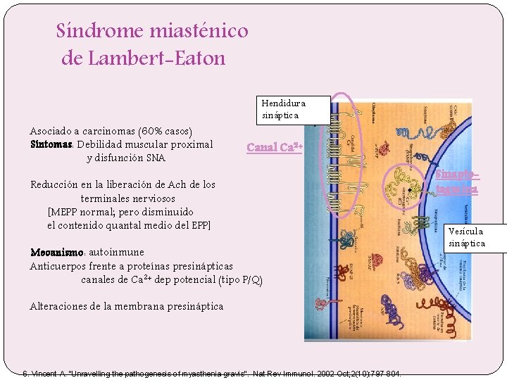 Síndrome miasténico de Lambert-Eaton Asociado a carcinomas (60% casos) Síntomas: Debilidad muscular proximal y