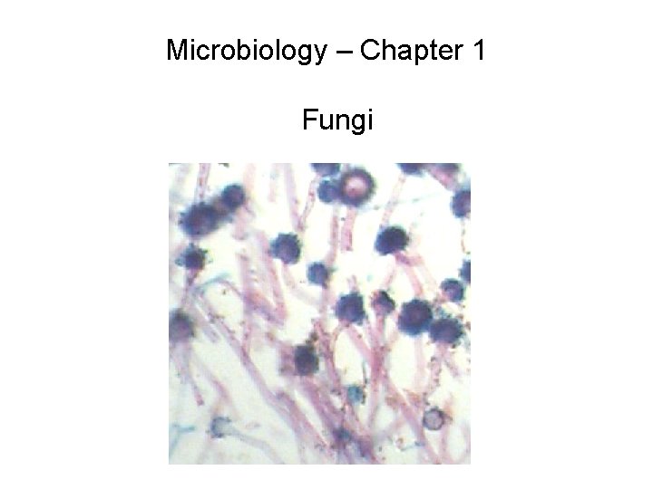 Microbiology – Chapter 1 Fungi 