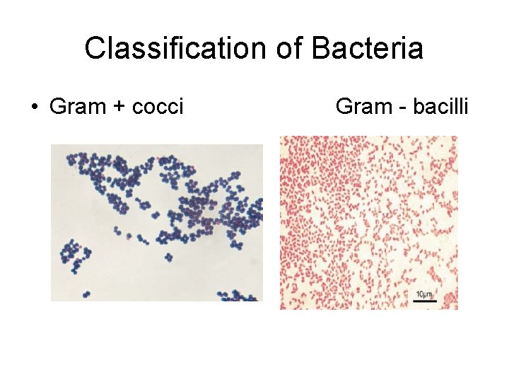 Classification of Bacteria • Gram + cocci Gram - bacilli 