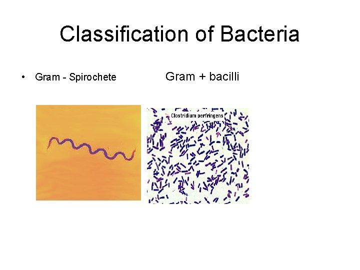 Classification of Bacteria • Gram - Spirochete Gram + bacilli 