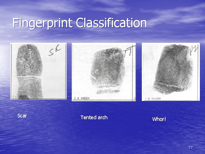 Fingerprint Classification Scar Tented arch Whorl 17 