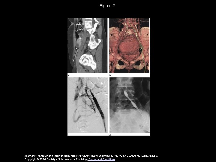 Figure 2 Journal of Vascular and Interventional Radiology 2004 15249 -256 DOI: (10. 1097/01.