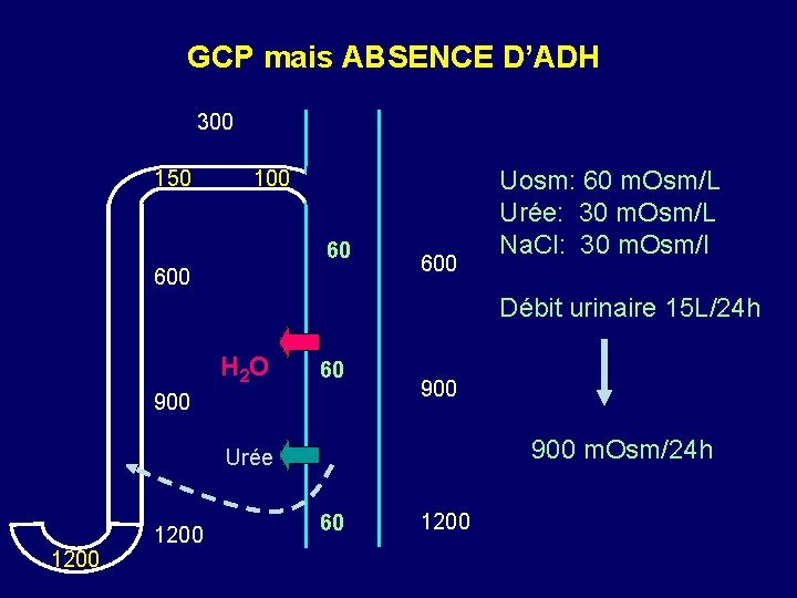 GCP mais ABSENCE D’ADH 300 150 100 60 600 Uosm: 60 m. Osm/L Urée: