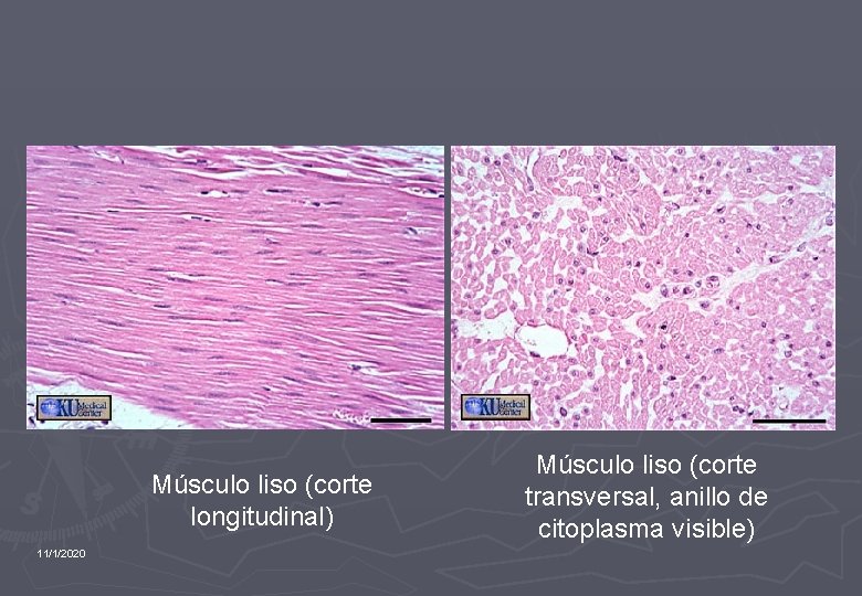 Músculo liso (corte longitudinal) 11/1/2020 Músculo liso (corte transversal, anillo de citoplasma visible) 
