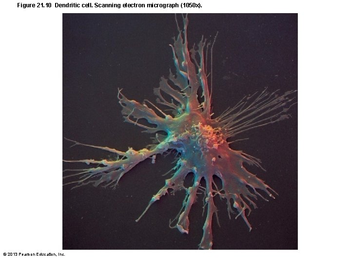 Figure 21. 10 Dendritic cell. Scanning electron micrograph (1050 x). © 2013 Pearson Education,