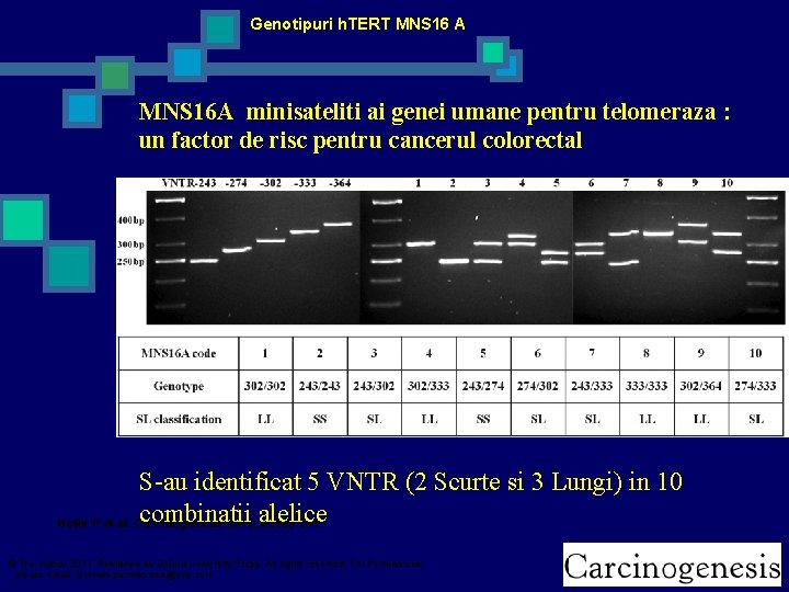 Genotipuri h. TERT MNS 16 A MNS 16 A minisateliti ai genei umane pentru