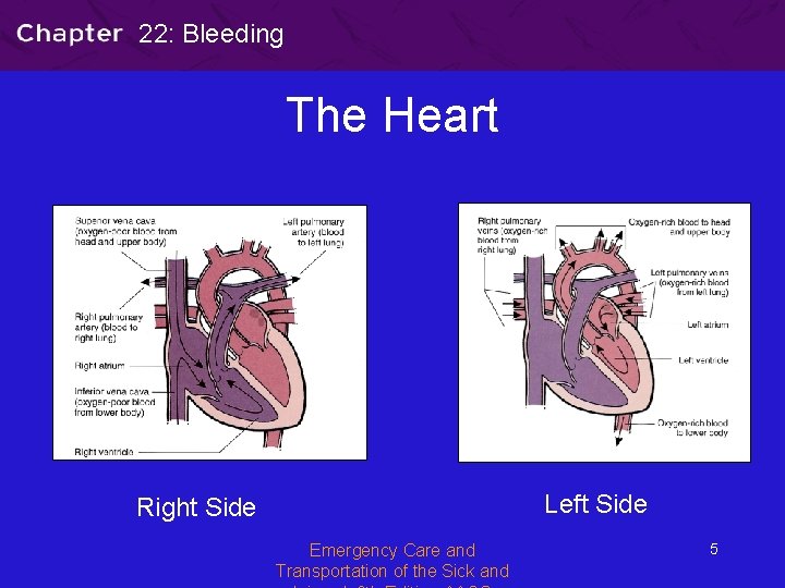 22: Bleeding The Heart Left Side Right Side Emergency Care and Transportation of the