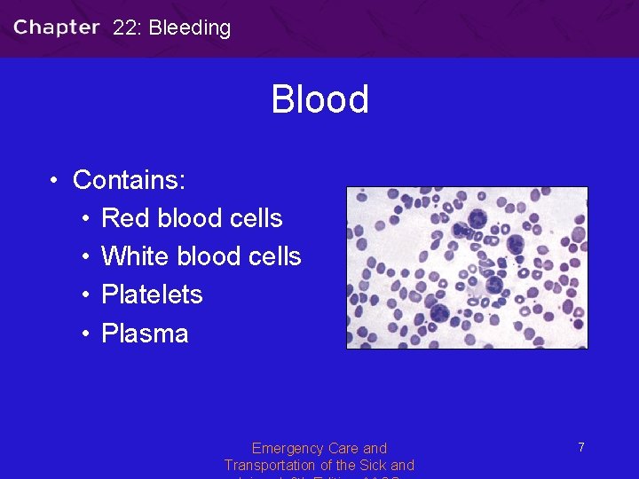 22: Bleeding Blood • Contains: • Red blood cells • White blood cells •