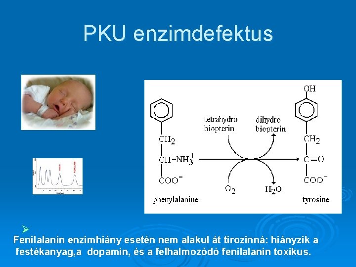 PKU enzimdefektus Ø Fenilalanin enzimhiány esetén nem alakul át tirozinná: hiányzik a festékanyag, a