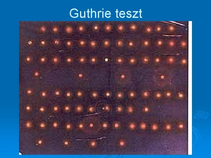 Guthrie teszt 