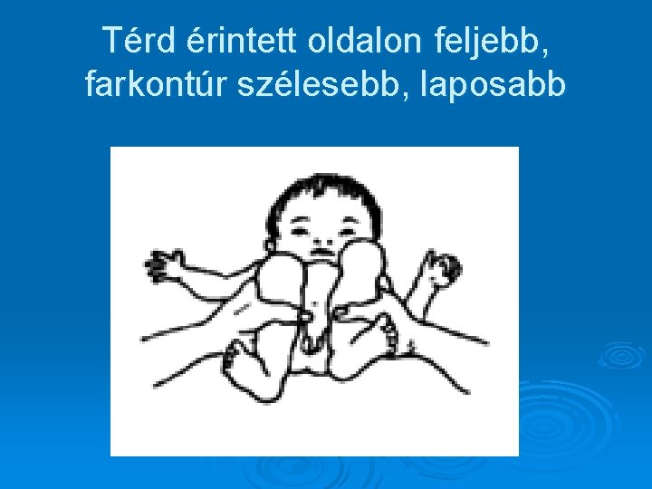 Térd érintett oldalon feljebb, farkontúr szélesebb, laposabb 