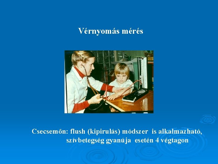 Vérnyomás mérés Csecsemőn: flush (kipirulás) módszer is alkalmazható, szívbetegség gyanúja esetén 4 végtagon 