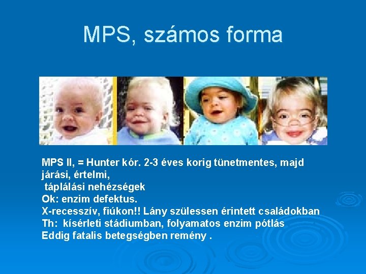 MPS, számos forma MPS II, = Hunter kór. 2 -3 éves korig tünetmentes, majd