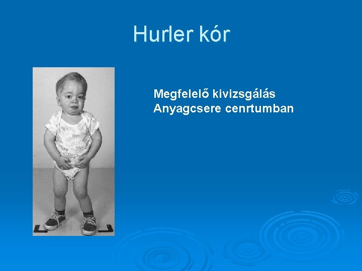 Hurler kór Megfelelő kivizsgálás Anyagcsere cenrtumban 