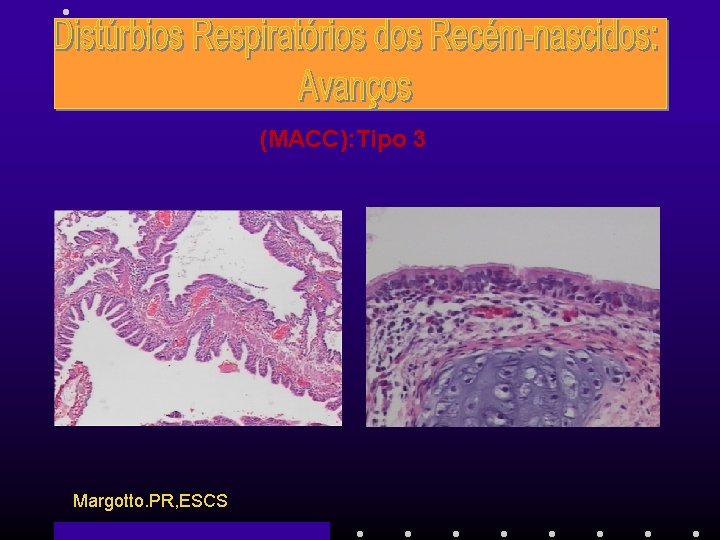 (MACC): Tipo 3 Margotto. PR, ESCS 