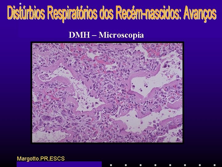 DMH – Microscopia Margotto. PR, ESCS 