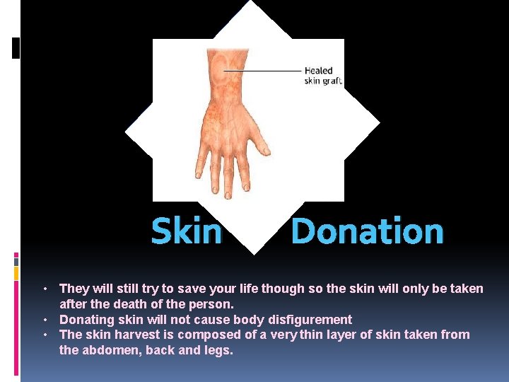 Skin Donation • They will still try to save your life though so the