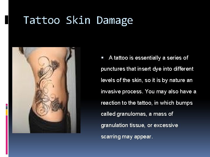 Tattoo Skin Damage A tattoo is essentially a series of punctures that insert dye