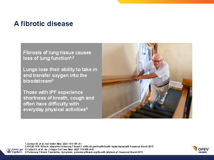 A fibrotic disease Fibrosis of lung tissue causes loss of lung function 1, 2