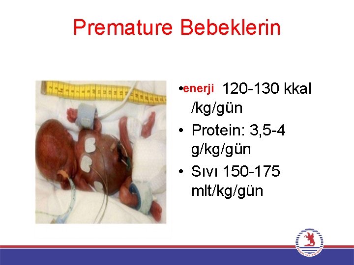 Premature Bebeklerin • enerji 120 -130 kkal /kg/gün • Protein: 3, 5 -4 g/kg/gün