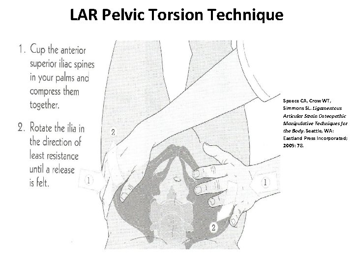 LAR Pelvic Torsion Technique Speece CA, Crow WT, Simmons SL. Ligamentous Articular Strain Osteopathic