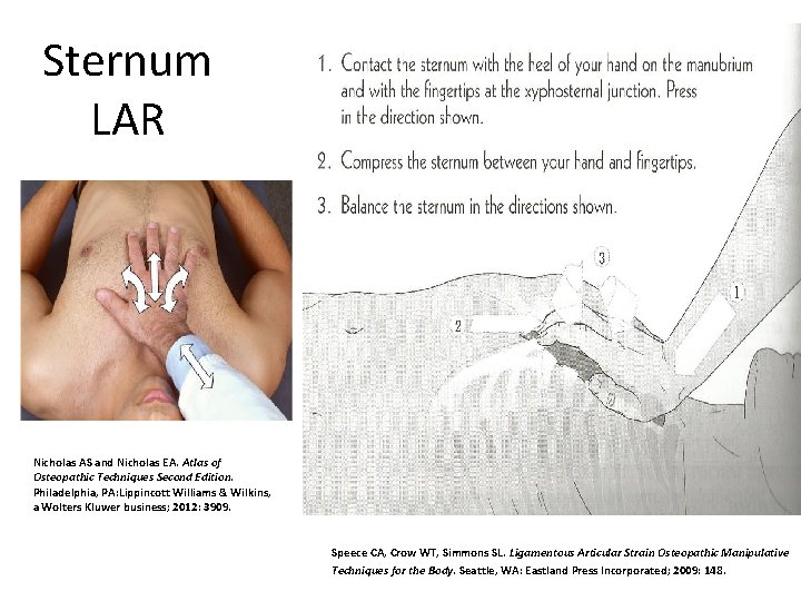 Sternum LAR Nicholas AS and Nicholas EA. Atlas of Osteopathic Techniques Second Edition. Philadelphia,