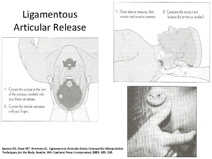 Ligamentous Articular Release Speece CA, Crow WT, Simmons SL. Ligamentous Articular Strain Osteopathic Manipulative