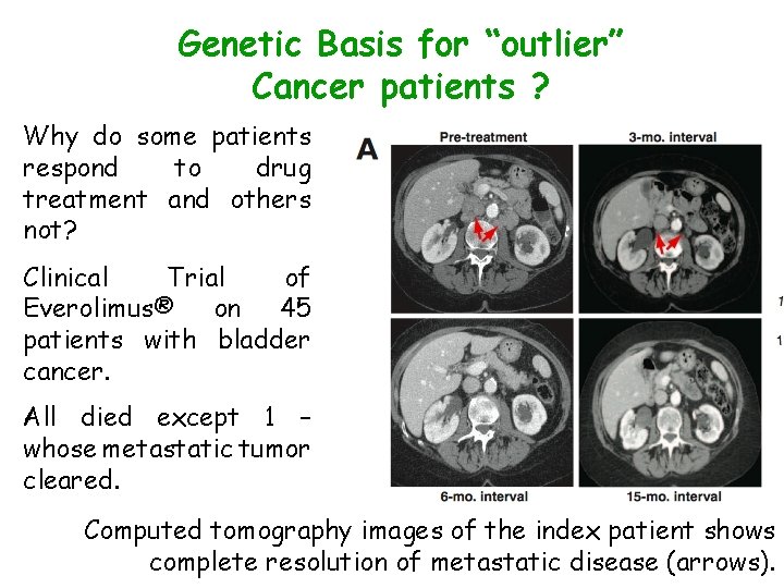 Genetic Basis for “outlier” Cancer patients ? Why do some patients respond to drug