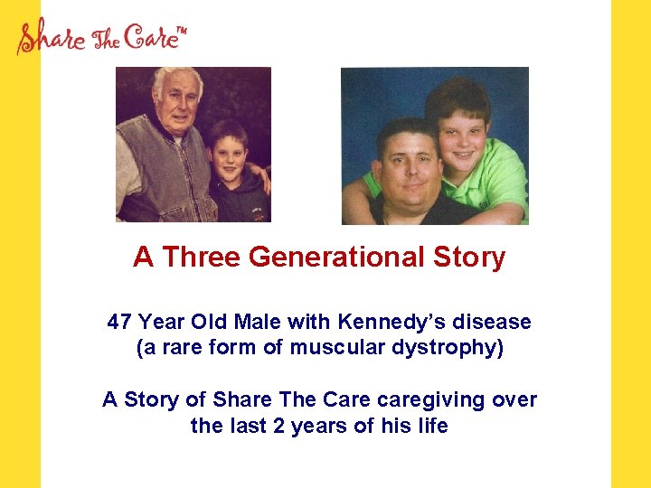 A Three Generational Story 47 Year Old Male with Kennedy’s disease (a rare form