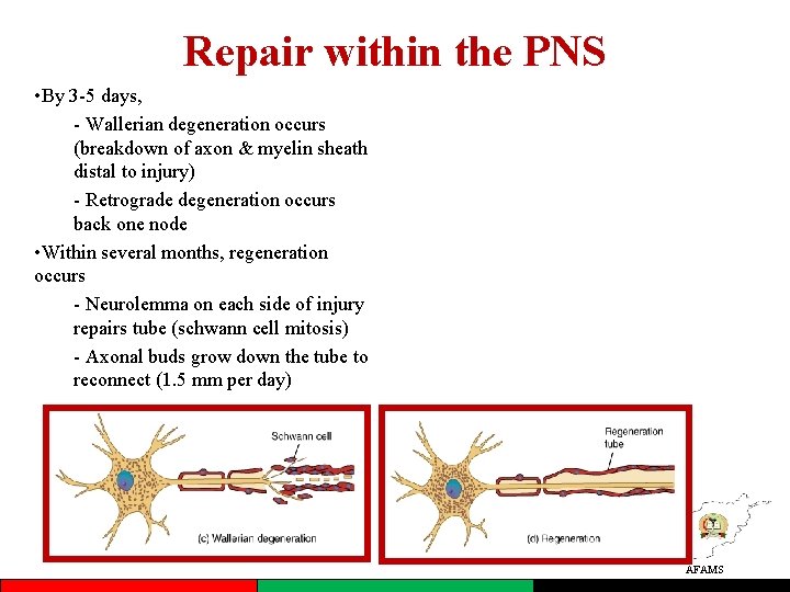 Repair within the PNS • By 3 -5 days, - Wallerian degeneration occurs (breakdown