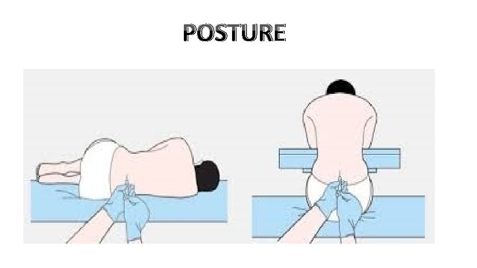 POSTURE 