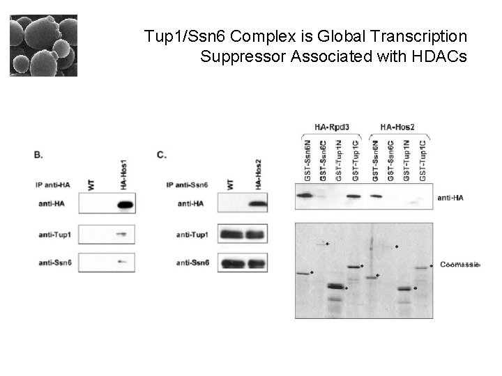 Tup 1/Ssn 6 Complex is Global Transcription Suppressor Associated with HDACs 