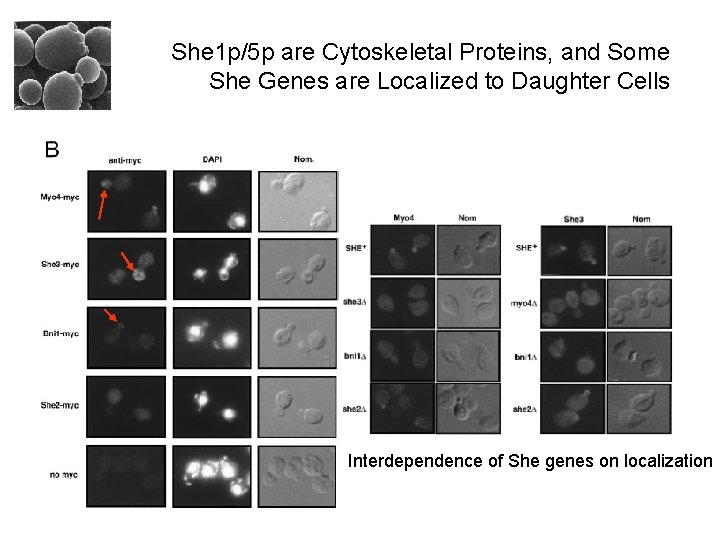 She 1 p/5 p are Cytoskeletal Proteins, and Some She Genes are Localized to