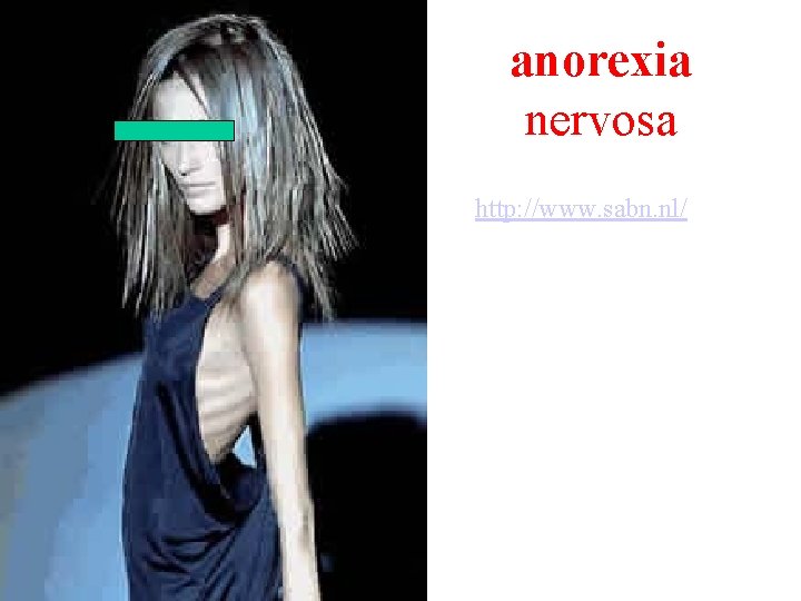 anorexia nervosa http: //www. sabn. nl/ 