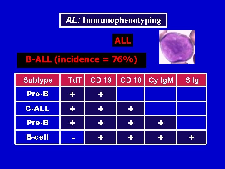 AL: Immunophenotyping ALL B-ALL (incidence = 76%) Subtype Pro-B C-ALL Pre-B B-cell Td. T