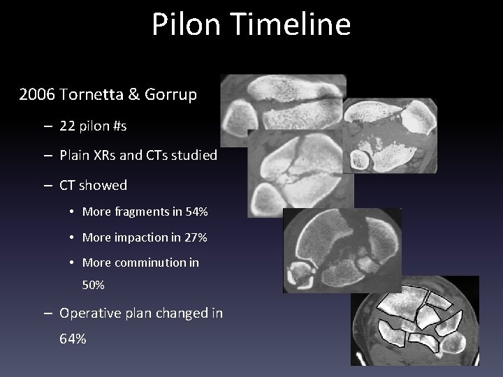 Pilon Timeline 2006 Tornetta & Gorrup – 22 pilon #s – Plain XRs and